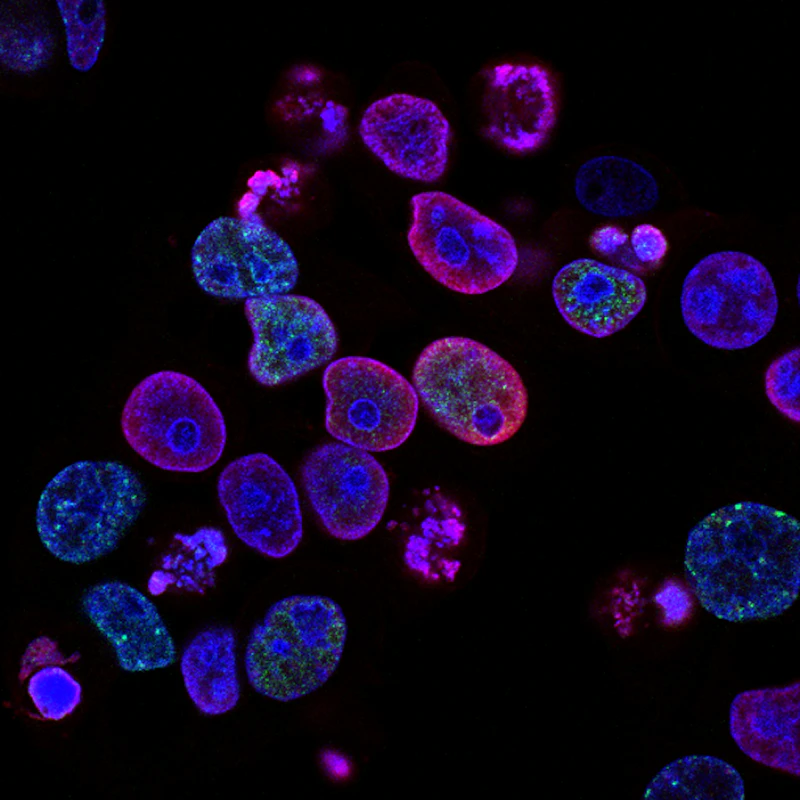Microbiological Culture Analysis in Field Lab